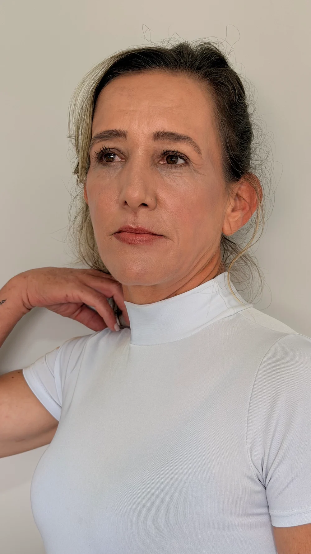 Depois de tratamento de rejuvenescimento facial